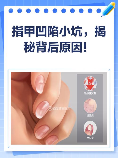 那些听着靠谱，实则伤指甲的坑