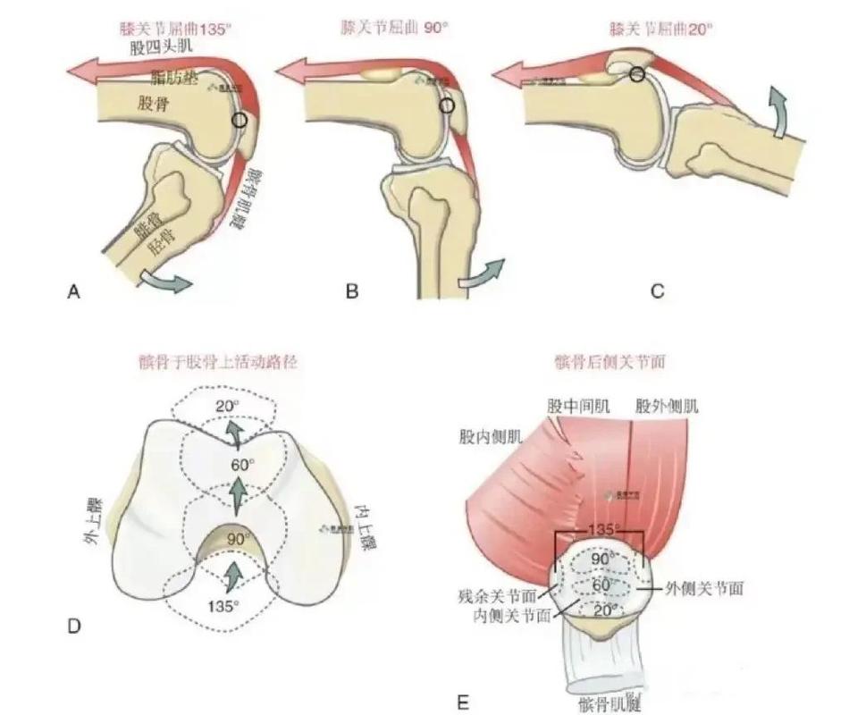 膝关节骨关节炎上下楼受力对比示意图