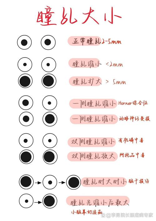 望远镜出瞳直径与瞳孔大小关系图解