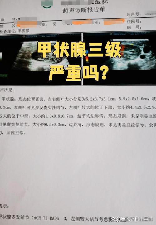甲状腺结节3级核保除外结论示例图