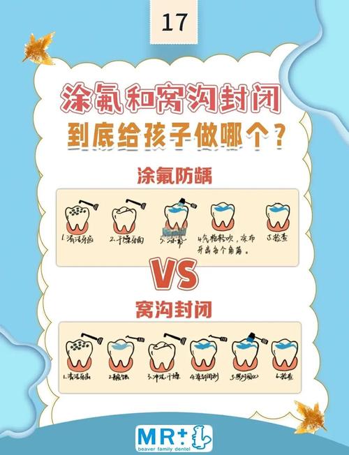 涂氟和窝沟封闭，别因为懒错过