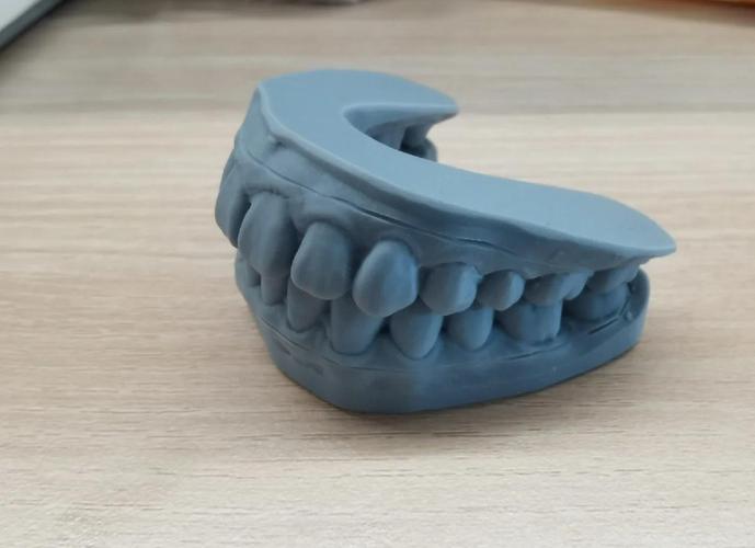 牙科诊所3D打印定制保持器过程