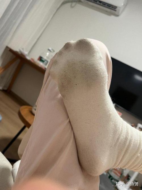 足癣患者错误晾晒鞋袜实景图