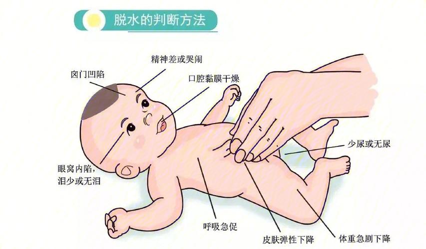婴幼儿宝宝脱水症状对照图