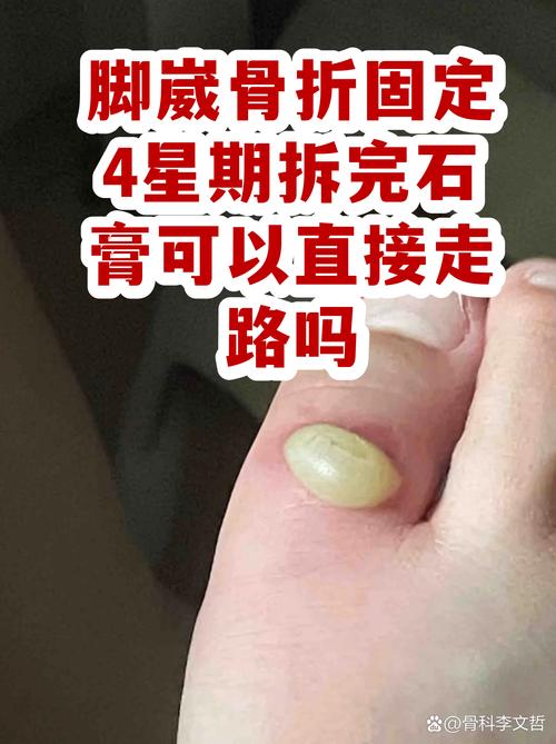 拆完别放着，要落回自己的脚边