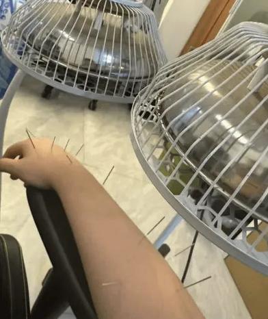 电竞选手手腕理疗场景
