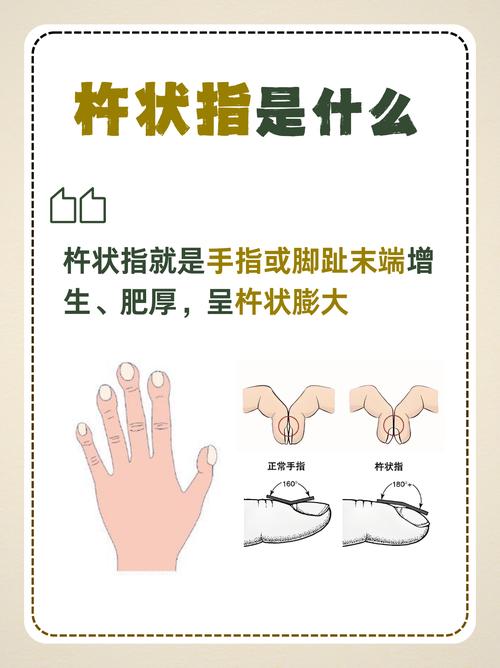 这些特殊情况，得顺着自己身体来