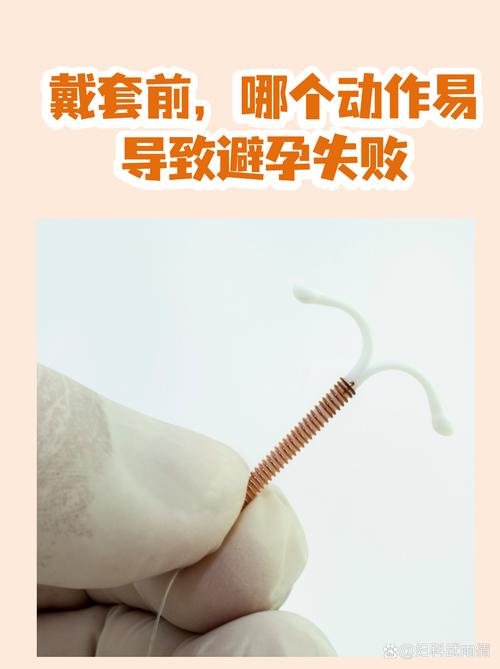 那些容易被忽略的“磨出来的麻烦”