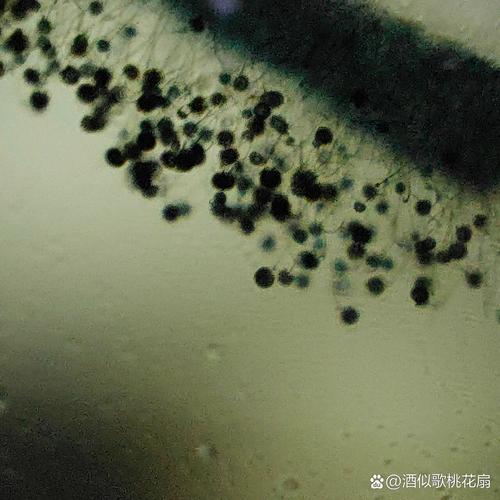 显微镜下的二手手机细菌样本