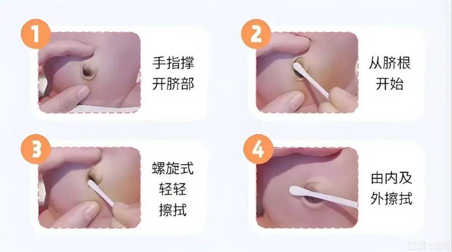 新生儿脐带护理正确操作示意图