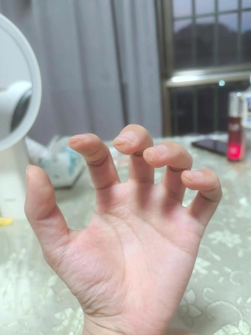 成年人弹吉他左手指尖茧子特写