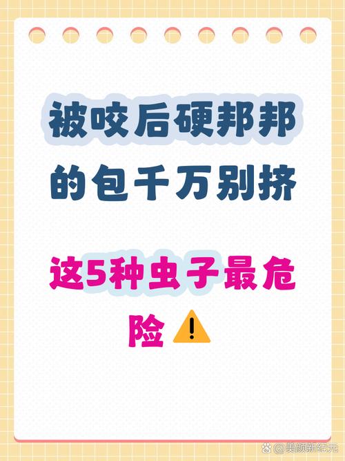 这几种包，再好看也劝你别碰❗