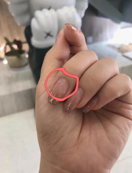 预防后续起翘问题