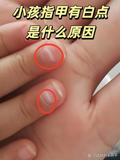 小孩把橡皮放在两个指甲之间实拍图