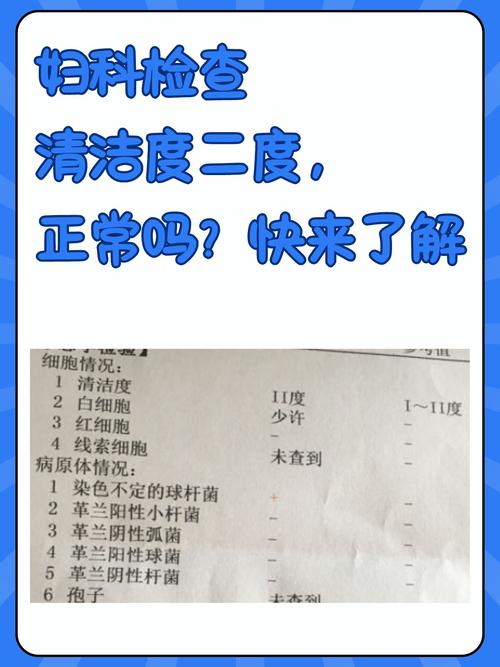 清洁完别忘了做这两项检查