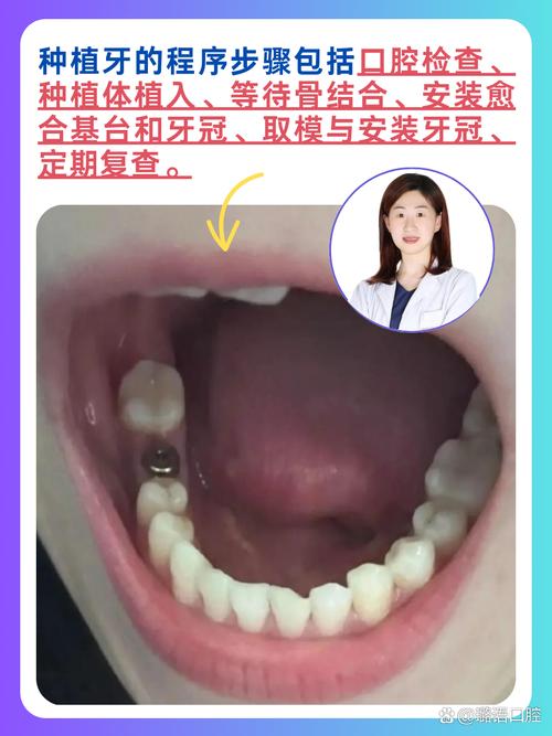 为什么要做牙齿记录？因为我栽过跟头
