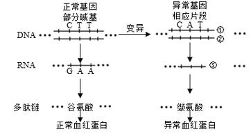 CRISPR基因编辑疗法治疗镰刀型细胞贫血症原理图