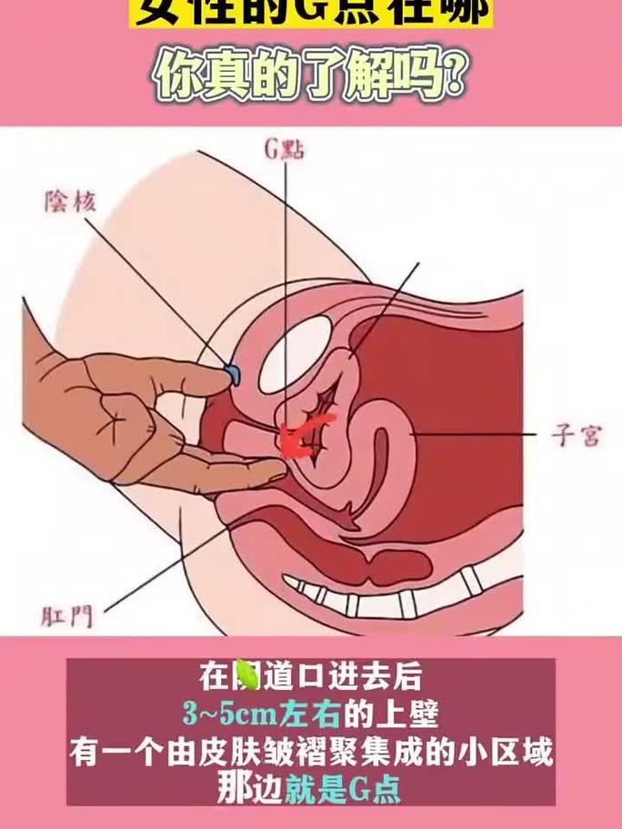 第一步：想清楚你要夹哪里
