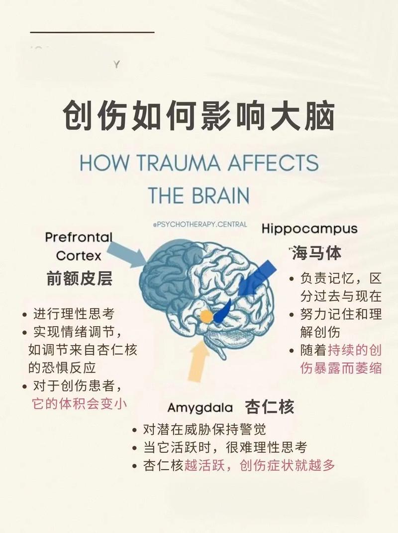 一、PCS的骨架没变,但大脑变了