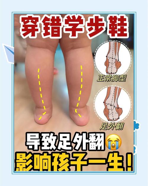 宝宝学步常见错误器具影响对比图