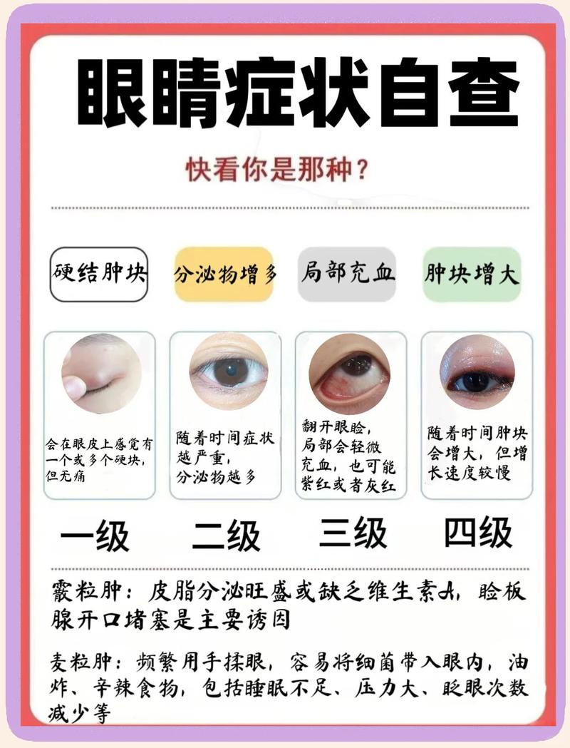 眼睛出了这些变化，该注意什么