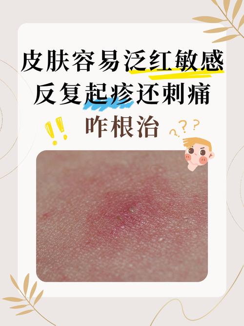 春季户外敏感性皮肤泛红实拍