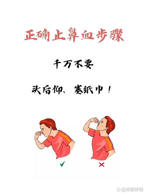 正确捏鼻翼止鼻血方法图解