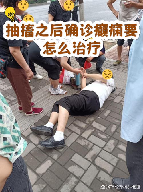 确诊癫痫之后,怎么陪它走下去
