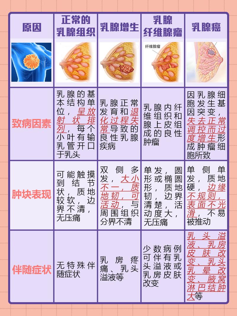 哺乳期乳腺炎早期乳房硬块识别示意图