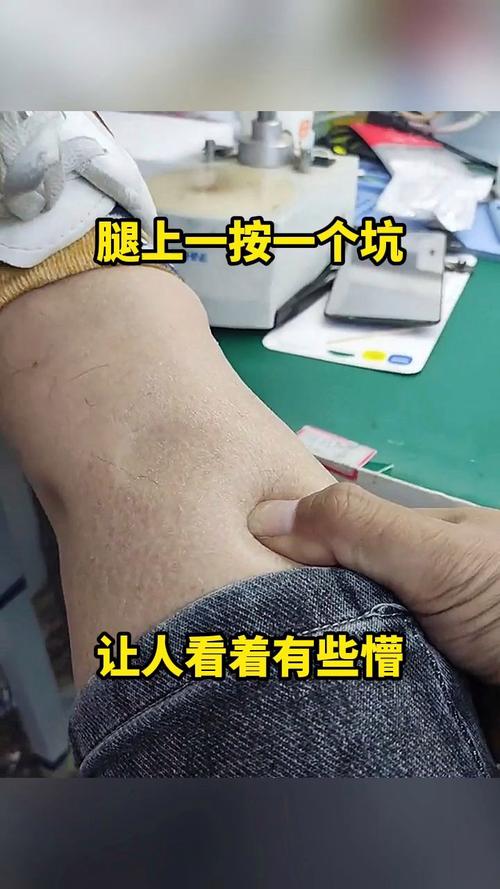 安装那些坑，踩一个都肉疼