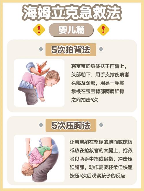 婴儿呛噎海姆立克急救操作示意图