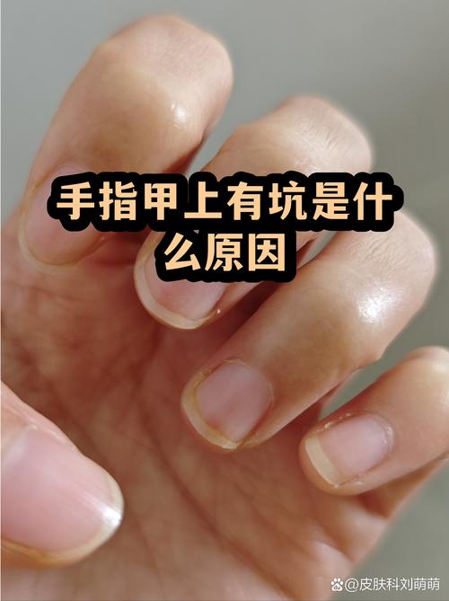 四、别忽视的坑和现实局限