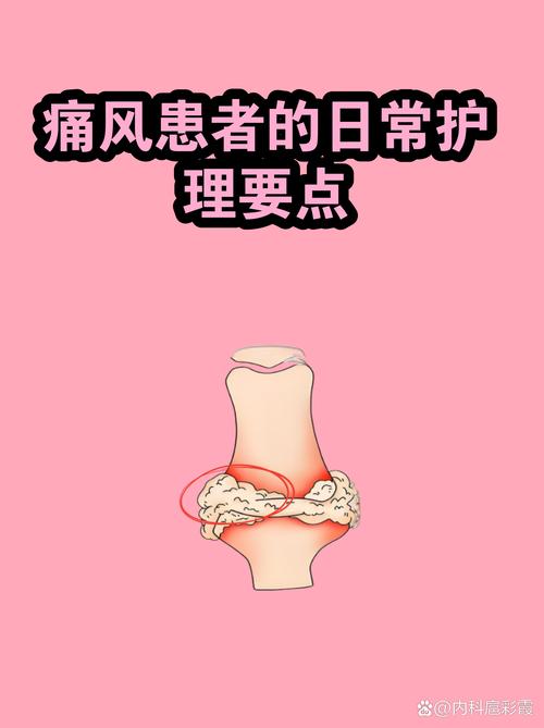 痛风不同受累关节急性发作护理图