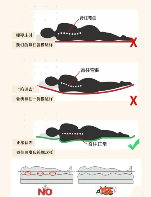 不同硬度床垫腰椎生理曲度对比图