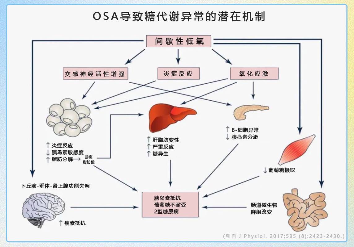 餐后血糖升高引发困倦路径图