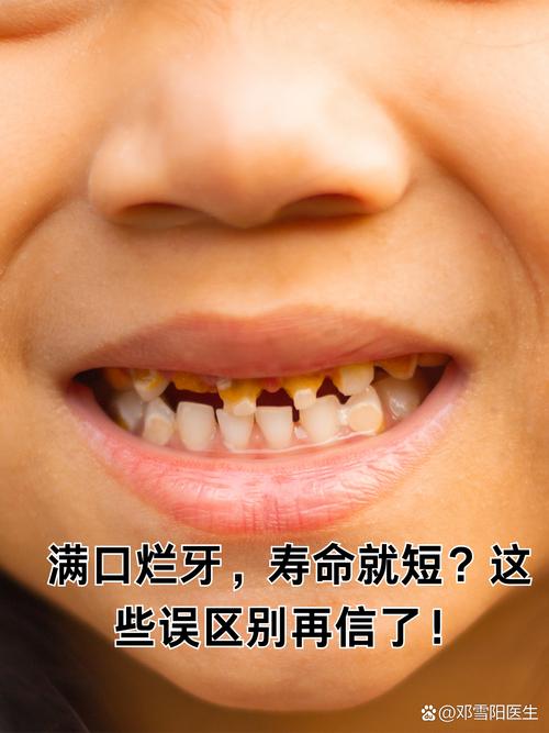 传烂了的误区，别再上当