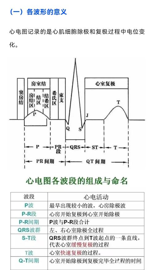 人工智能心电图诊断分析示意图