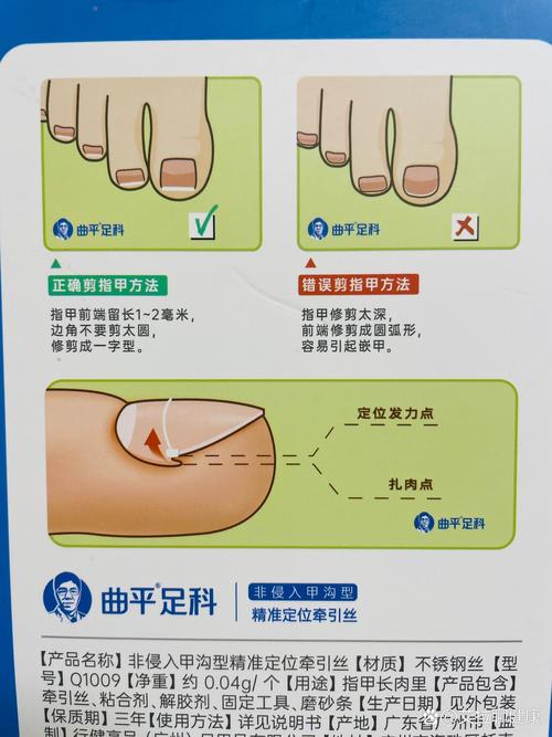 正确修剪脚趾甲方法 防止嵌甲