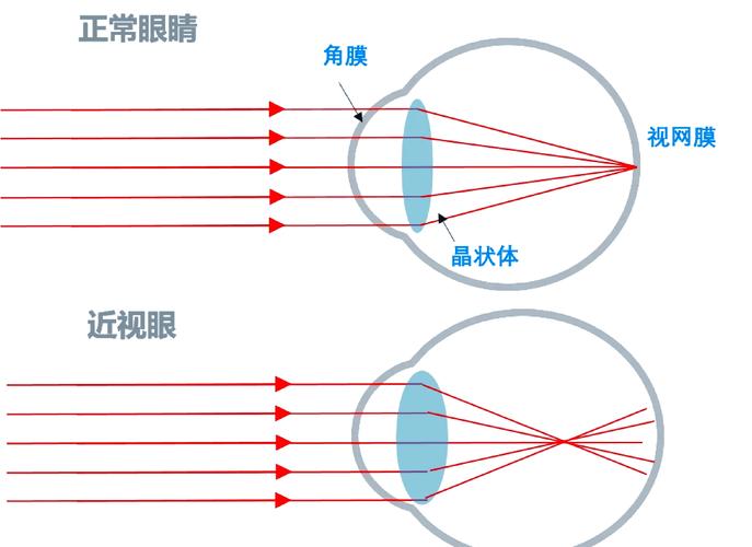 不同强度光线对眼睛影响示意图