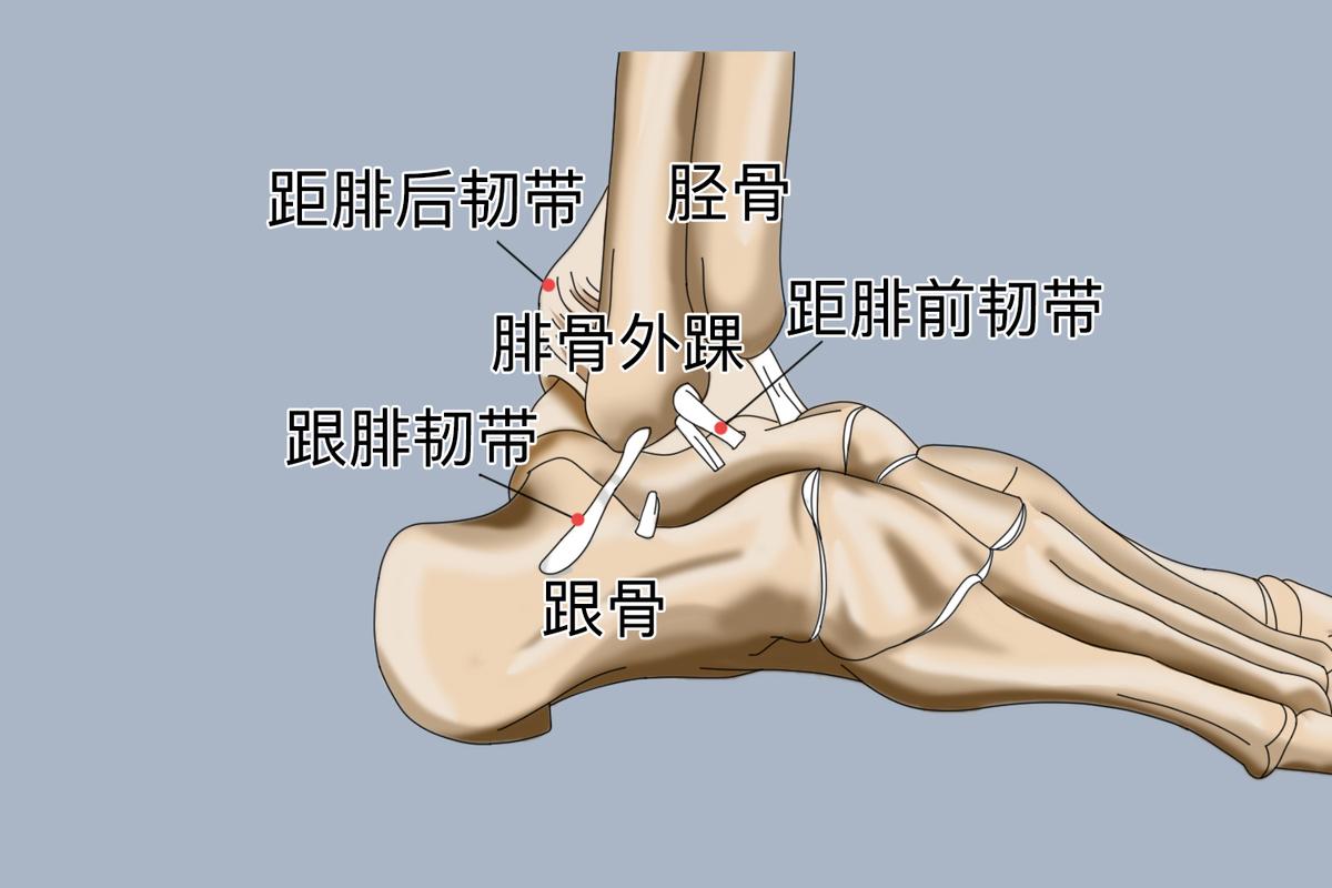 跟腱炎抬高足跟鞋垫结构示意图