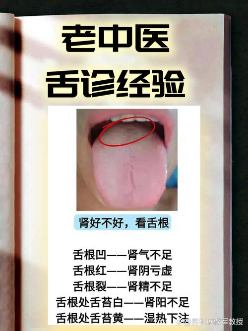 老中医门诊看舌象 场景实拍