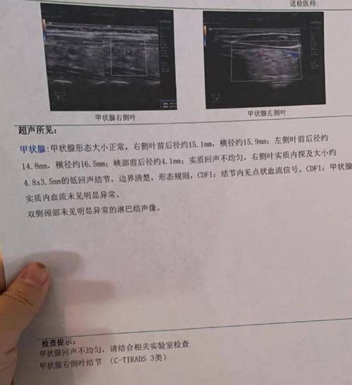 甲状腺3类结节超声报告截图