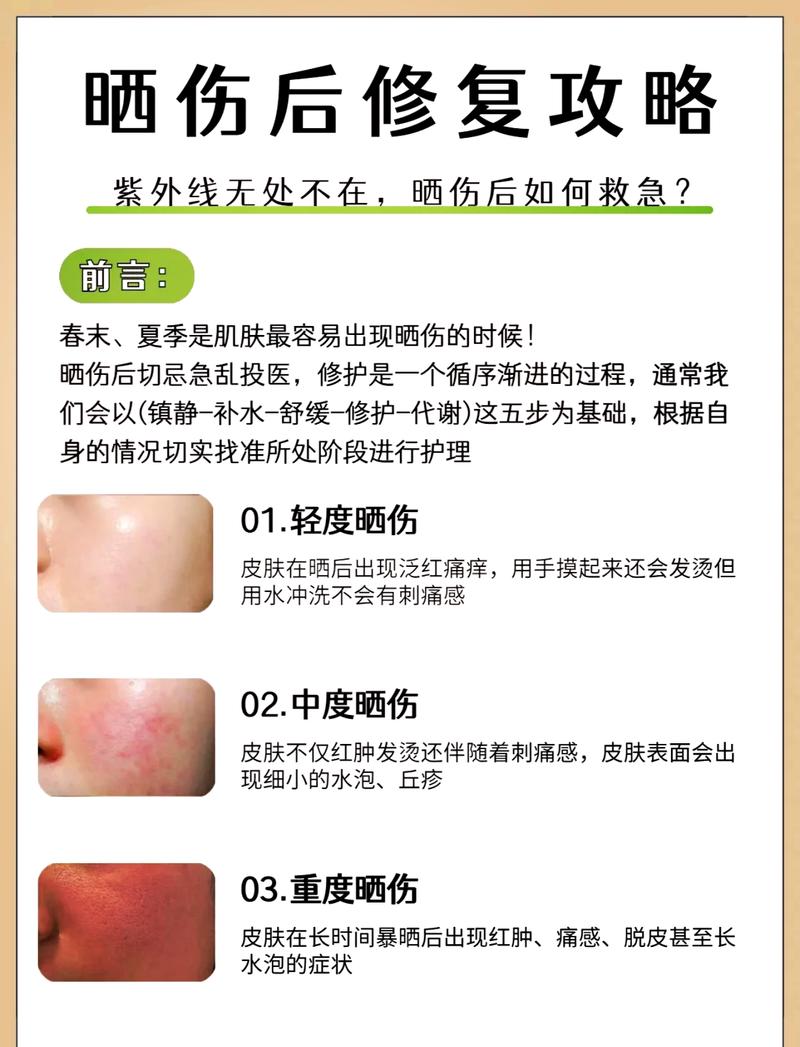 晒后:别急着美白,先安抚皮肤