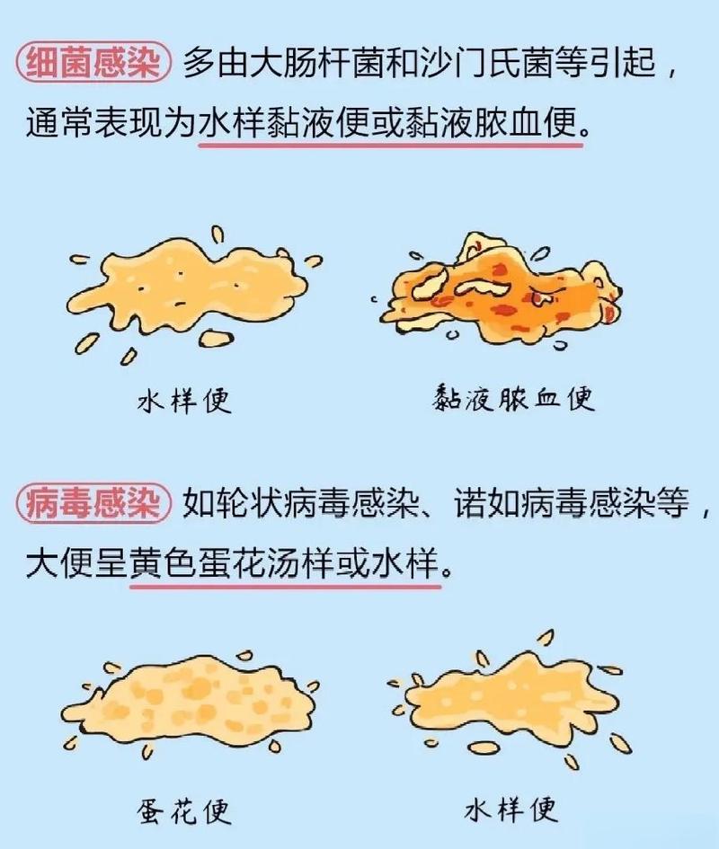 小儿秋季腹泻大便性状对比图