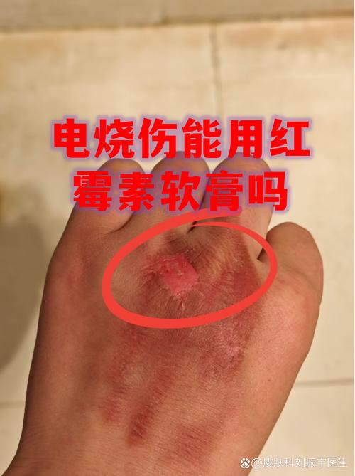 电池可以自己“愈合”了？是的，像皮肤一样