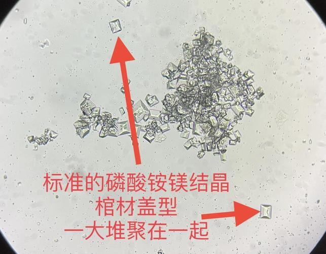 猫尿液中磷酸铵镁结晶的显微实拍图