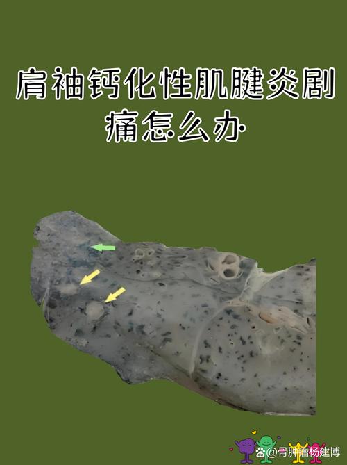 超级宝贝就医红线:这些情况别硬扛
