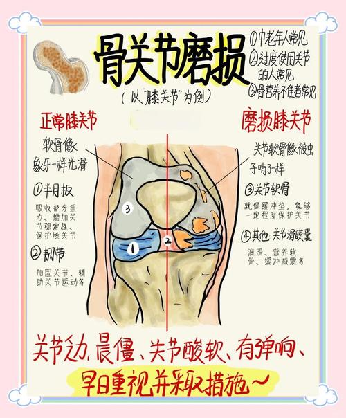 能不能从一开始就避免关节提前磨损？