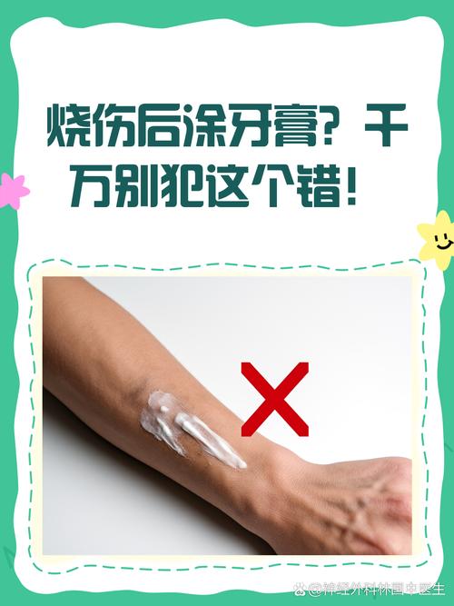 烫伤:别再用牙膏酱油了,这是给自己挖坑