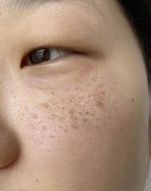 镀层薄得像纸?氧化起斑才是噩梦